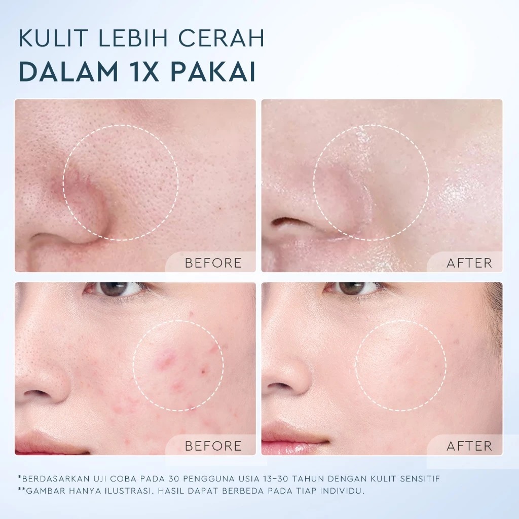 Glad 2 Glow Cleanser - Deep Pore Clean Facial Wash 70ml