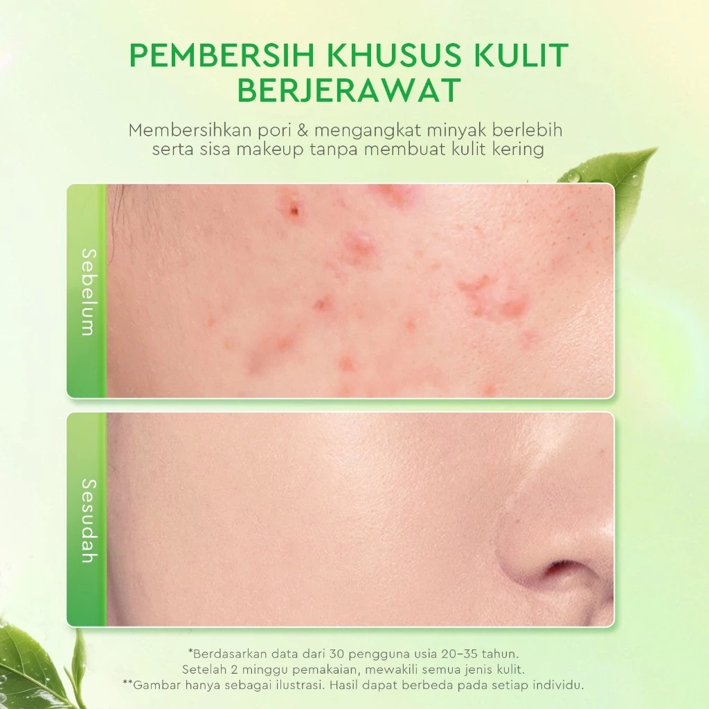 Glad 2 Glow Cleanser - Matcha Salicylic Acid Acne Facial Wash 80gr