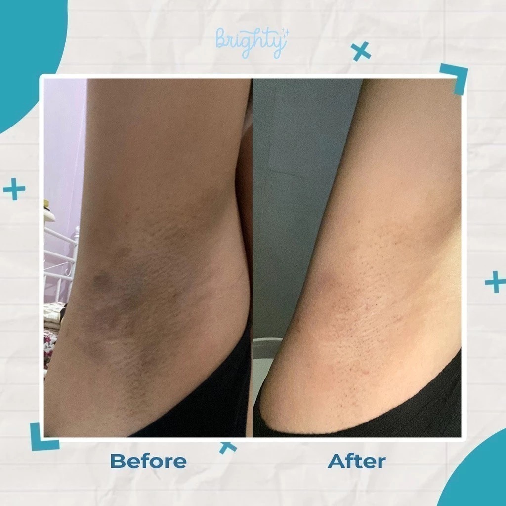 Brighty Underarm Scrub 100ml