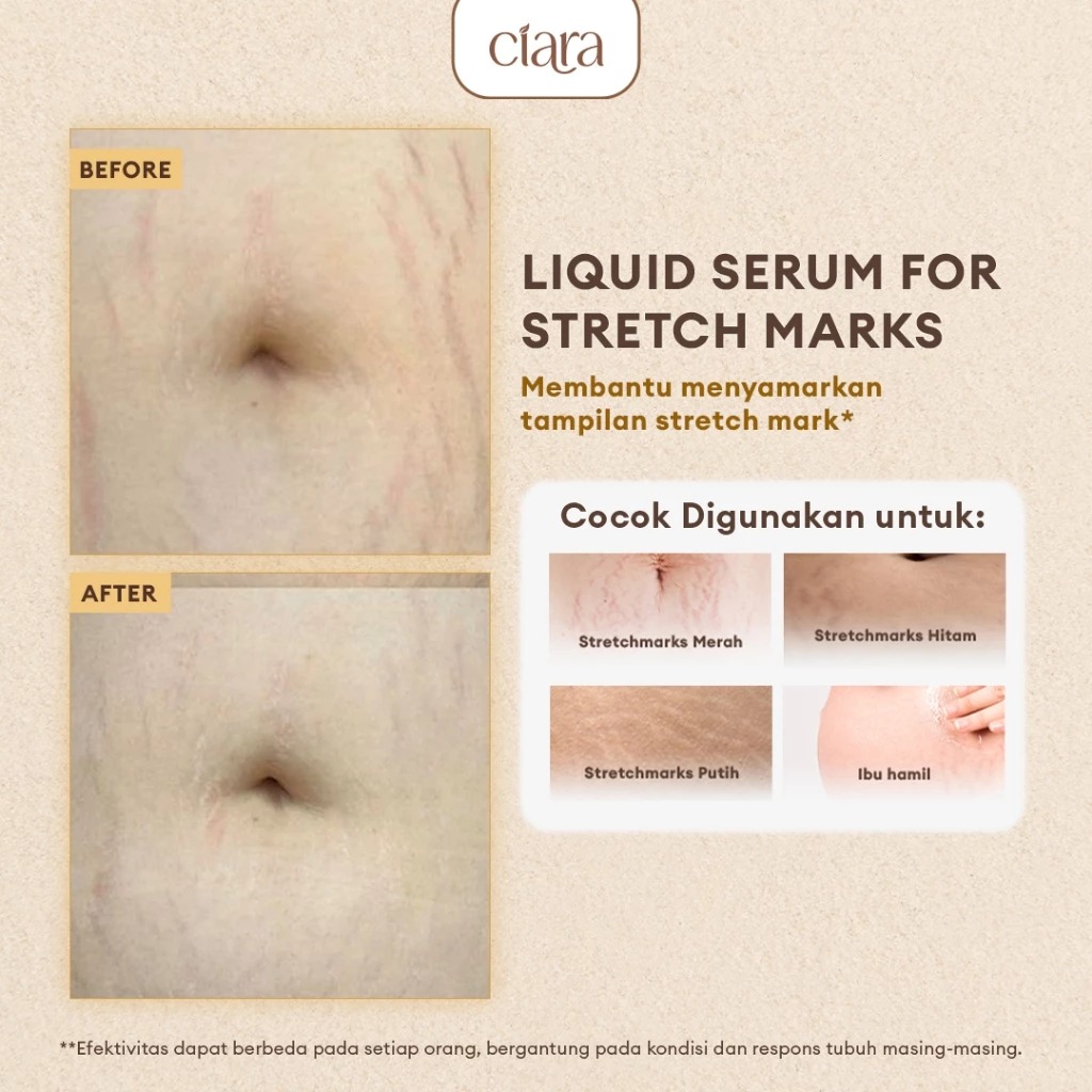 Ciara Liquid Serum for Stretch Marks 30ml