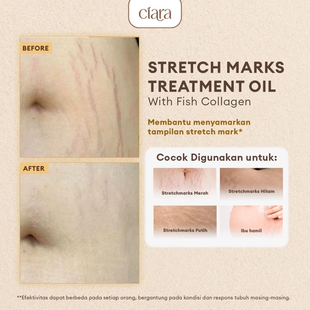 Ciara Stretchmark Treatment Oil with Fish Collagen & Apple Stemcell 100ml