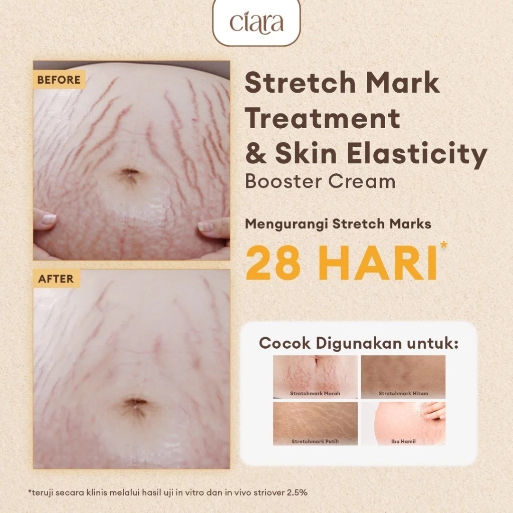 Ciara Stretch Mark Treatment Booster Cream 150ml