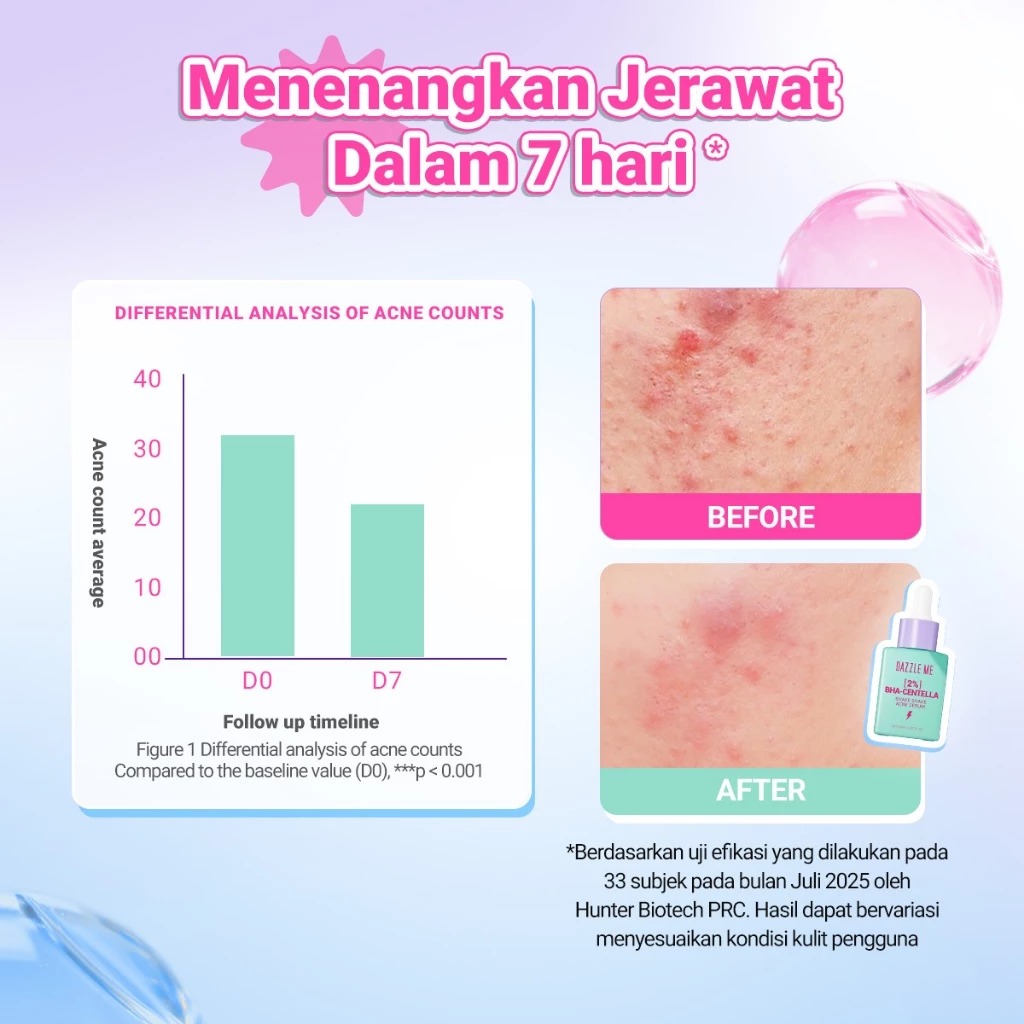 Dazzle Me 2% BHA - Centella Shake Shake Acne Serum 20ml