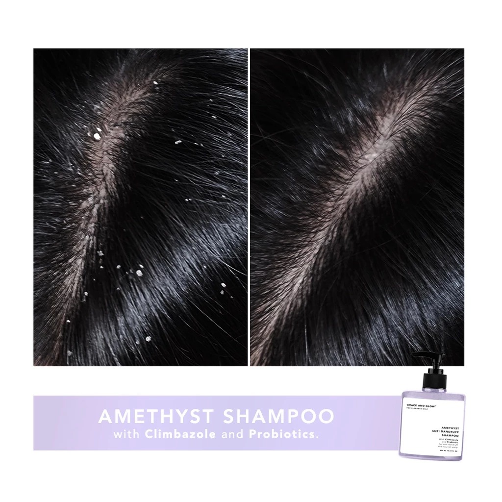 Grace and Glow Amethyst Dandruff and Nourish Care Shampoo 400ml