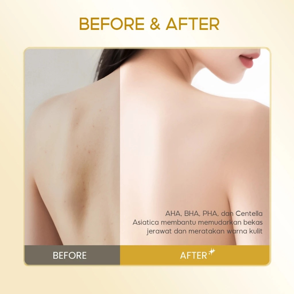 Grace and Glow English Pear and Freesia Anti Acne Solution Body Wash 400ml (Big Pump)