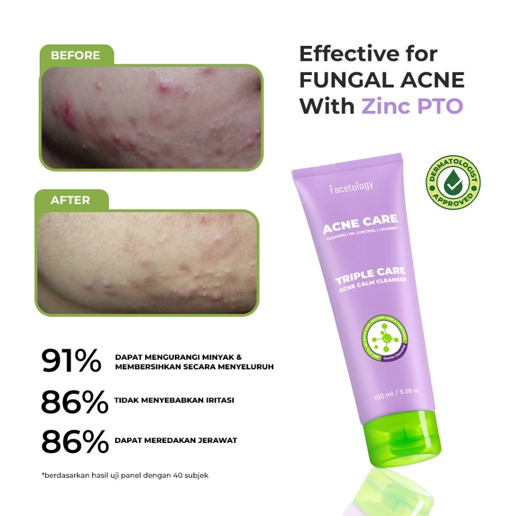 Facetology Triple Care Acne Calm Cleanser 100ml