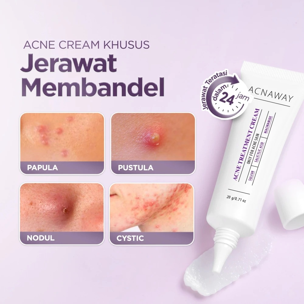 Acnaway Acne Treatment Cream 20gr