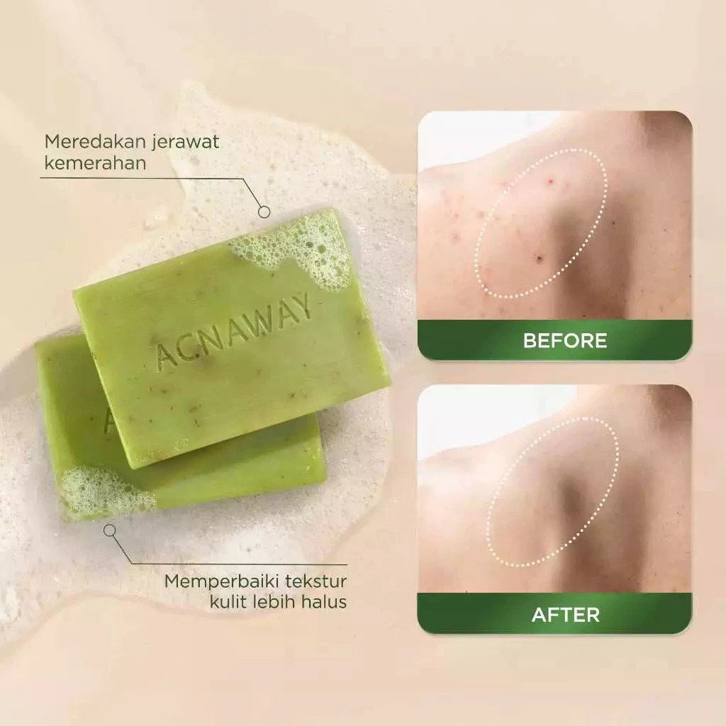 Acnaway Mugwort Acne Clear Bar Soap 100gr