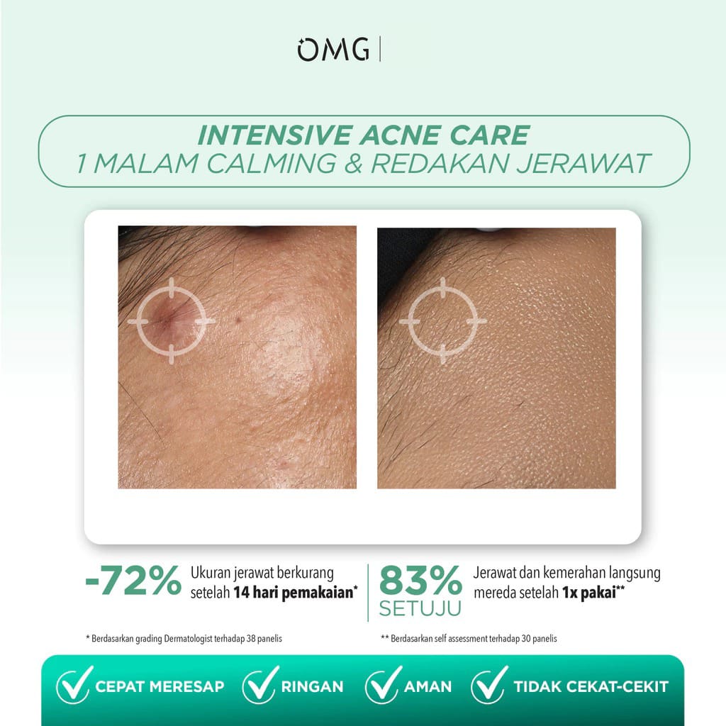 Oh My Glow Serum 17ml - 2% Salicylic Complex Acid Acne Intensive Solution Serum (OMG)