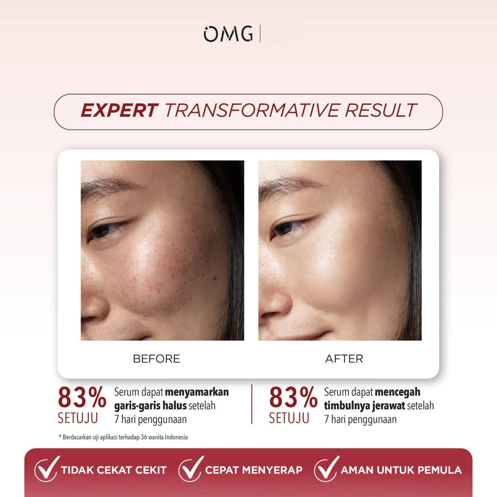 Oh My Glow Serum 17ml - 1% Ultra-Pro Retinol Pure Smooth Retinol Serum (OMG)