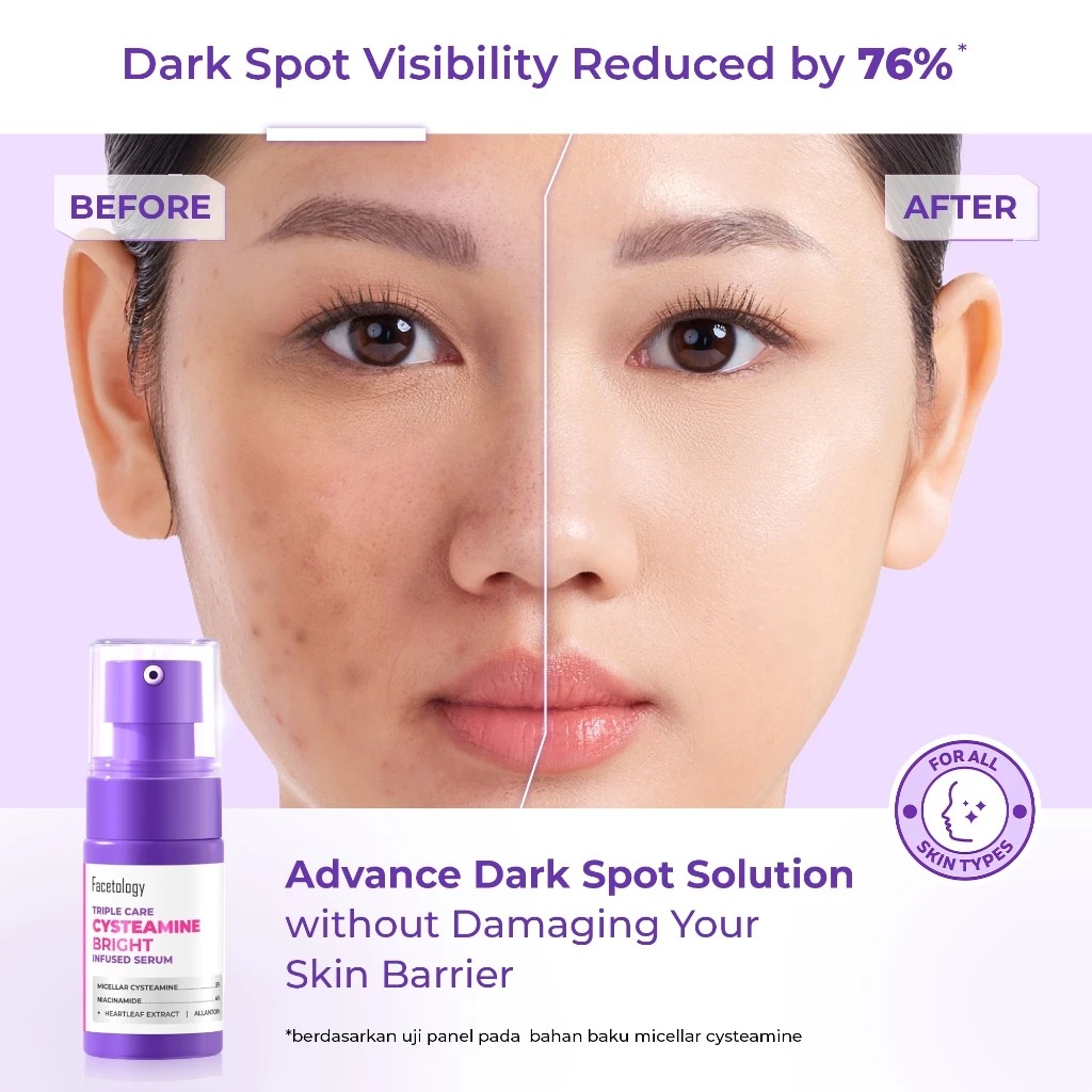 Facetology Triple Care Cysteamine Bright Infused Serum 15ml