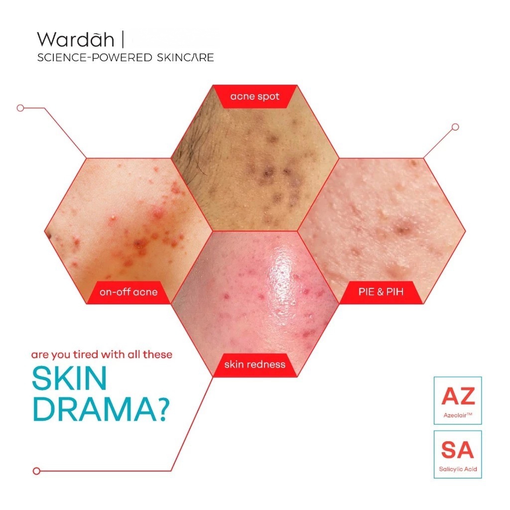 Wardah Acnederm Acne Relief Serum 20ml