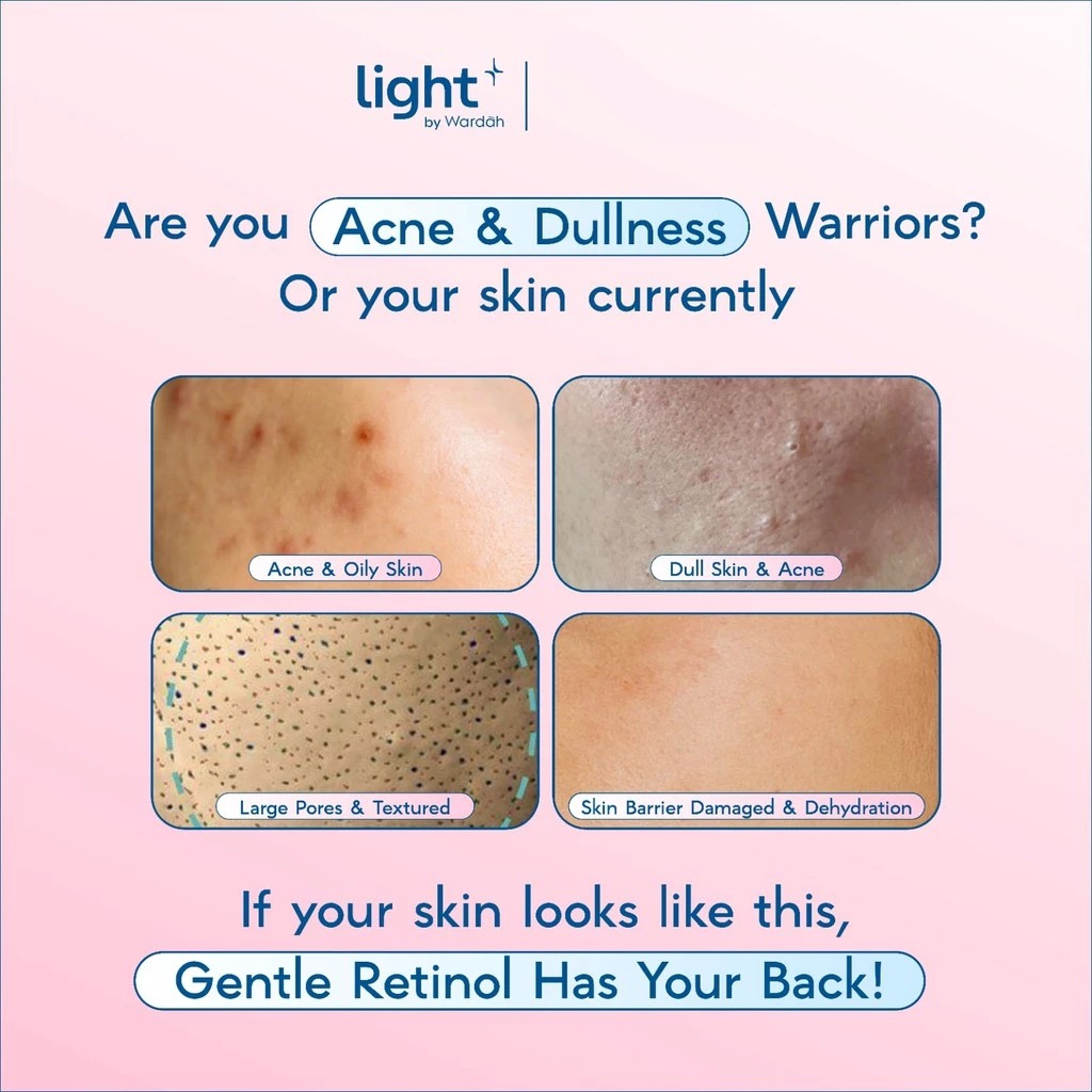 Wardah Light+ Serum Moisturizer 28gr - (HPR Retinoid Bright + Acne)