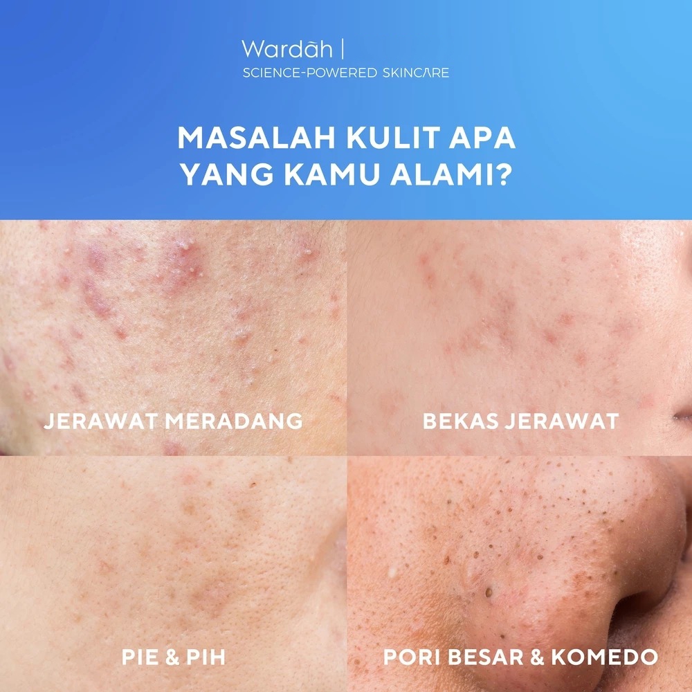 Wardah UV Shield Acne Calming Sunscreen Serum SPF50 PA++++ 100ml