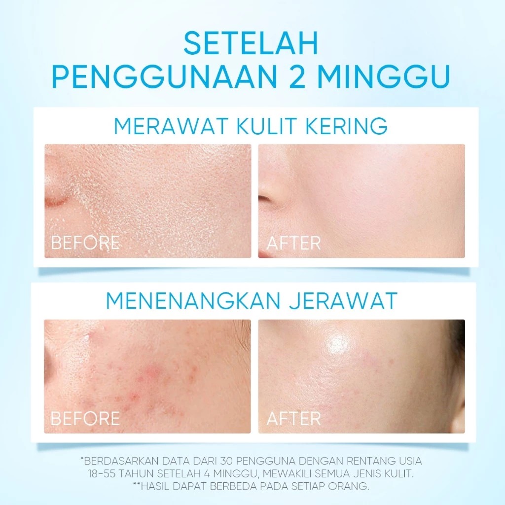 Skintific 5X Ceramide Barrier Moisture Gel 50gr