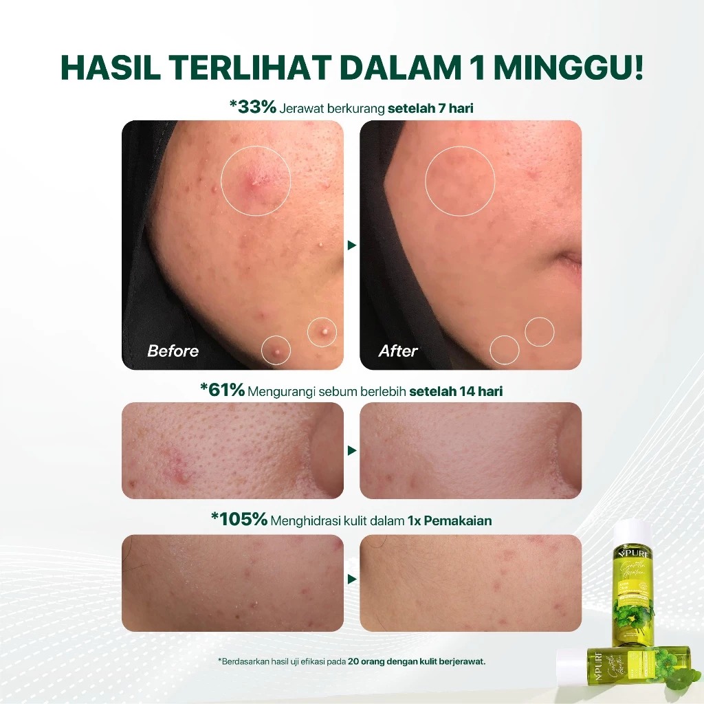 Npure Centella Face Toner 80ml