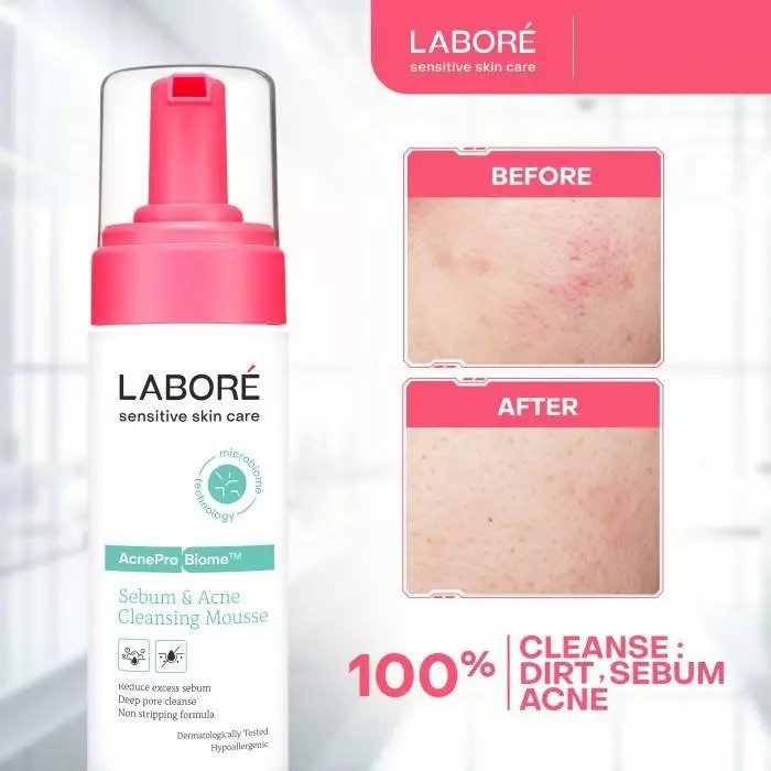 Labore AcnePro Biome Sebum & Acne Cleansing Mousse 25ml