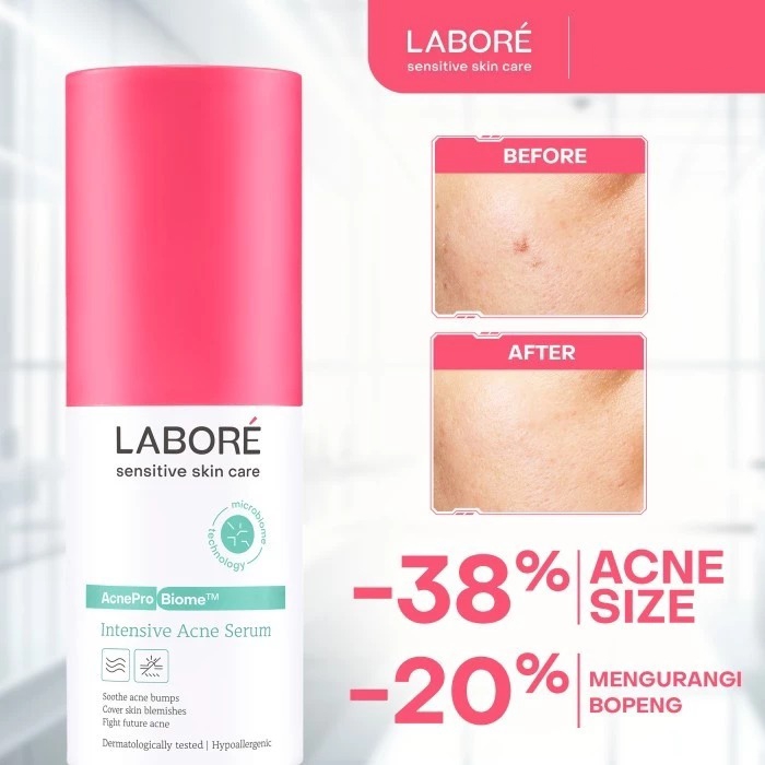 Labore AcnePro Biome Intensive Acne Serum 7ml