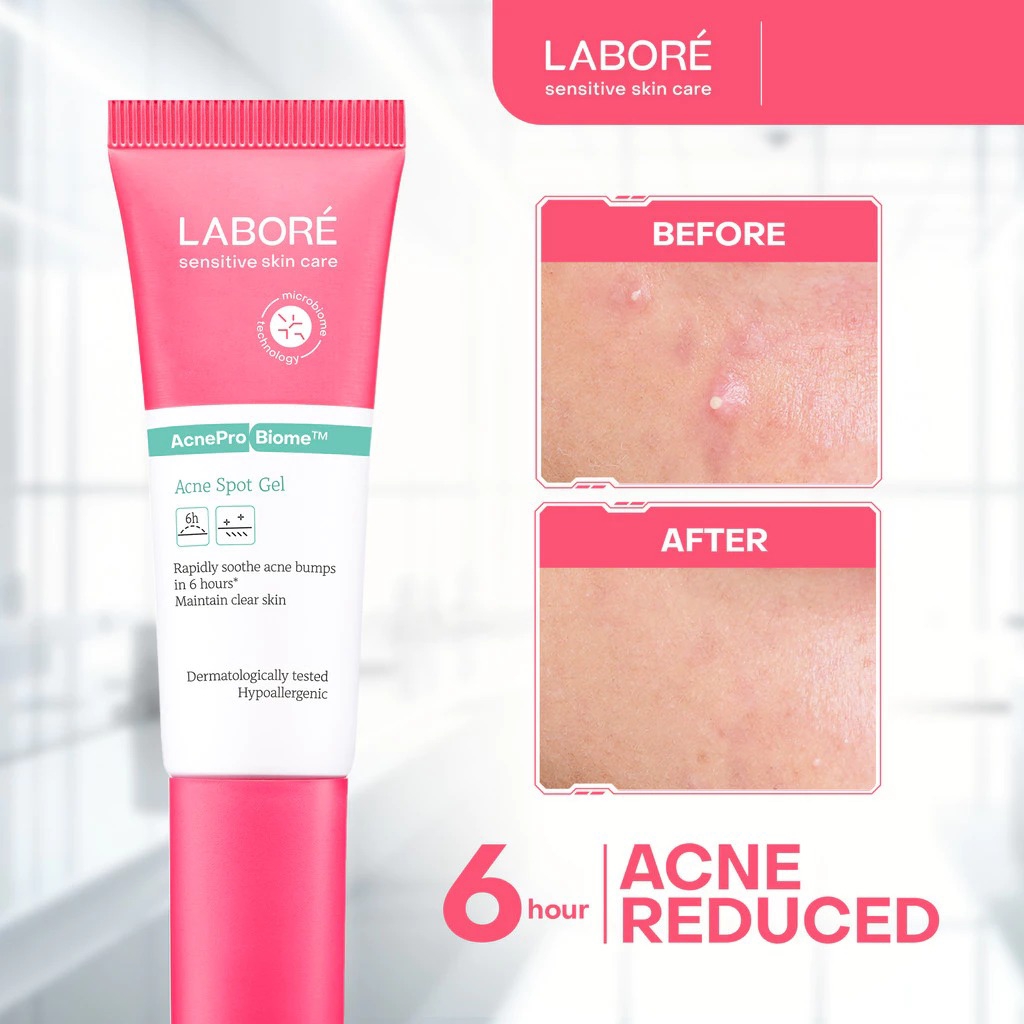 Labore AcnePro Biome Acne Spot Gel 15ml