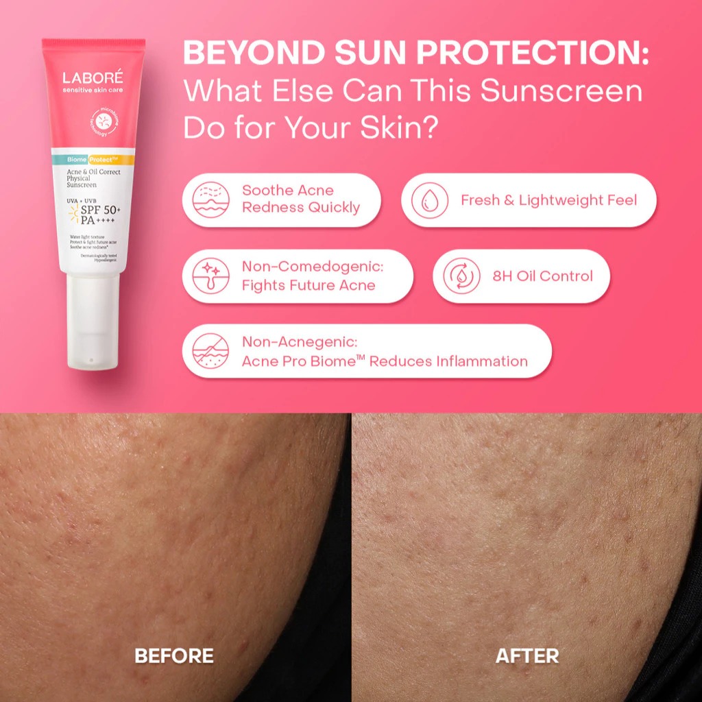 Labore Acne & Oil Correct Physical Sunscreen SPF50+ PA++++ 40ml (Biome Protect)