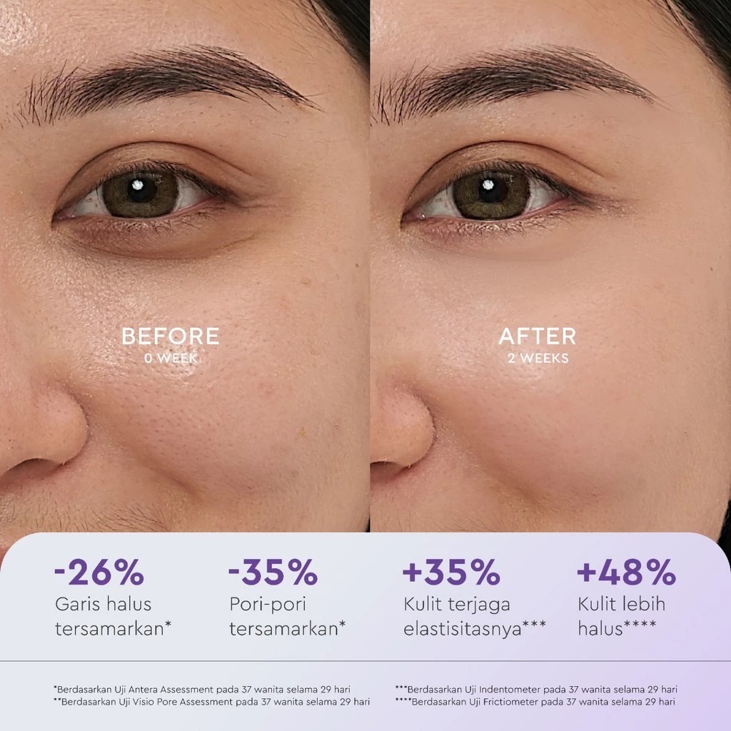 Wardah Renew You 1% Retinol Microcapsule Ceramide Cell Renewal Serum 30ml