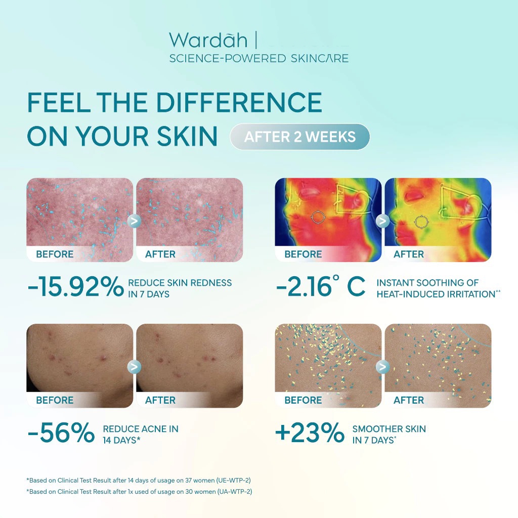 Wardah Madecassoside Ectoin Barrier Calming Toner Pad 50pcs 100ml