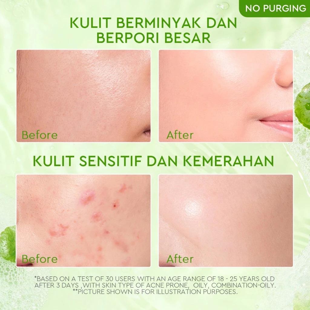 Glad 2 Glow Cleanser - Centella Salicylic Acid Acne Gel 150ml