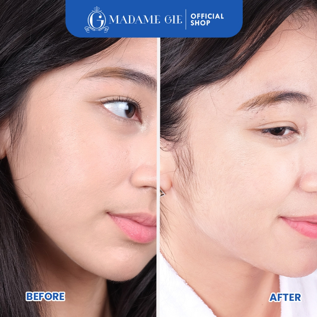 (Beli 2 Gratis 1) Madame Gie Necessity Sheet Mask 25ml - Glutaniacin (Bright)