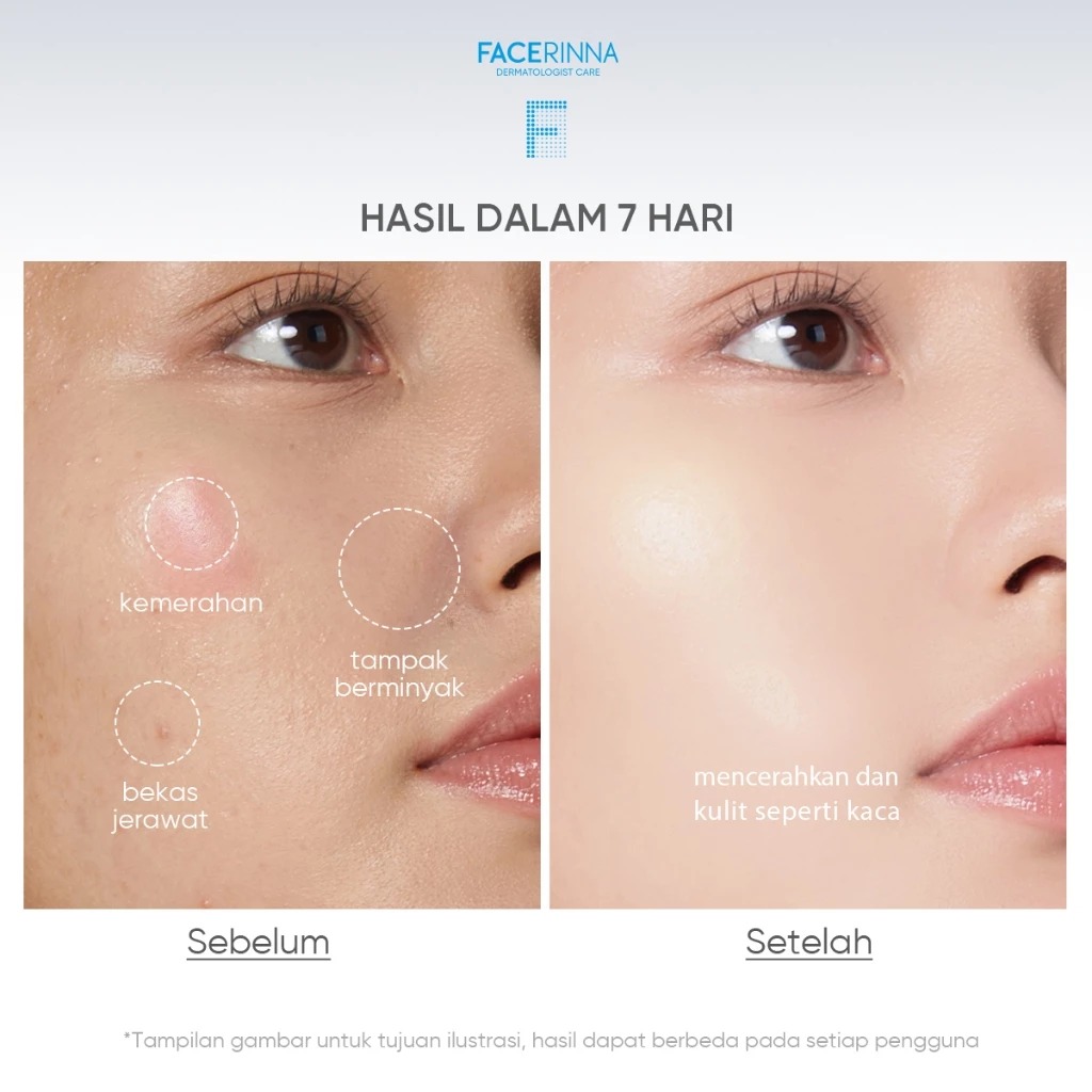 Facerinna 2% Niacinamide Power Bright Cleanser 120ml
