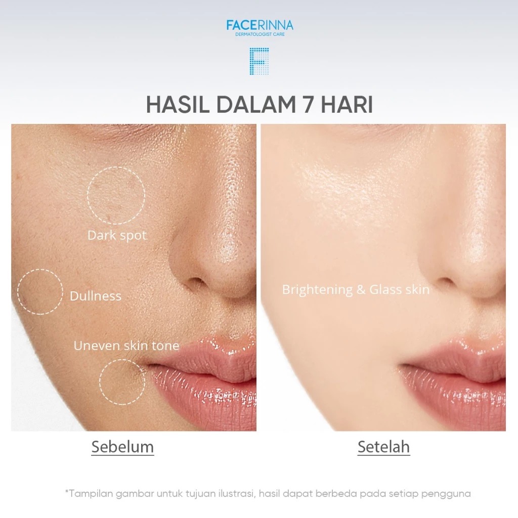 Facerinna 5% Niacinamide 1% TXA Bright  Dark Spot Moisturizer 30gr
