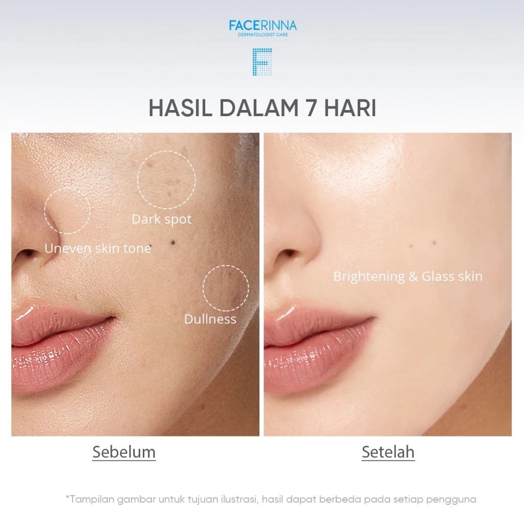 Facerinna 10% Niacinamide 3% TXA Bright  Dark Spot Serum 20ml