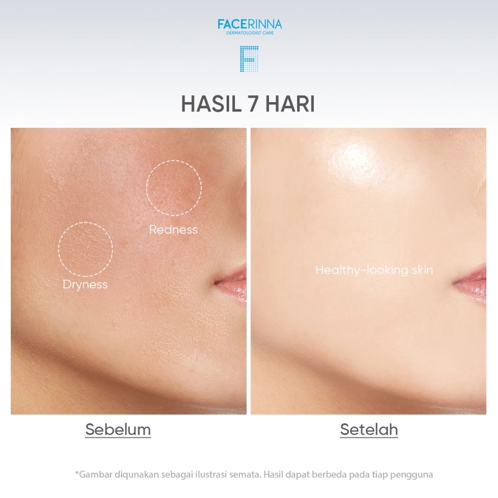 Facerinna Low PH B5 Gel Cleanser 120ml
