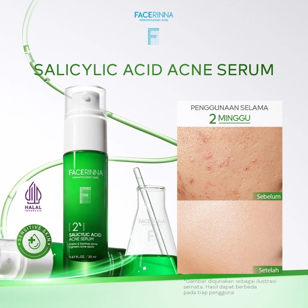 Facerinna 2% Salicylic Acid Acne Serum 20ml