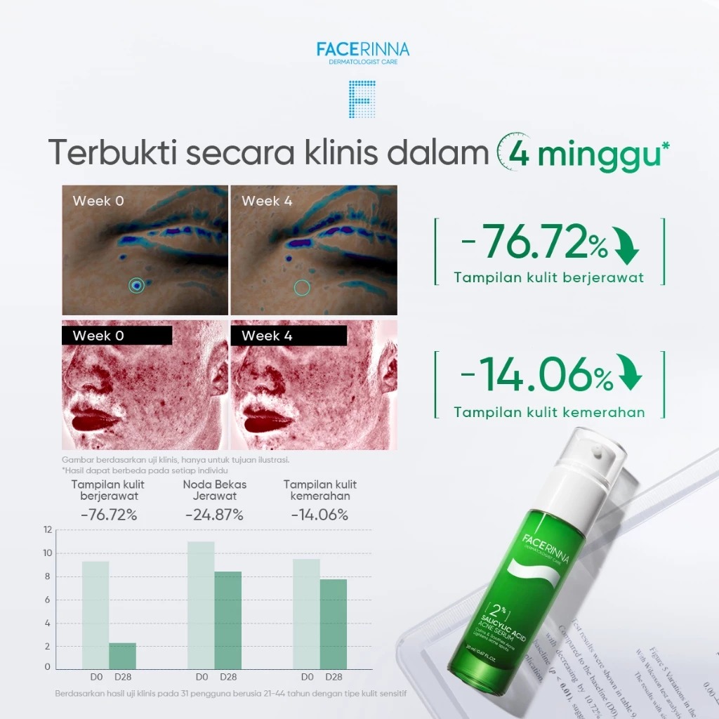 Facerinna 2% Salicylic Acid Acne Serum 20ml