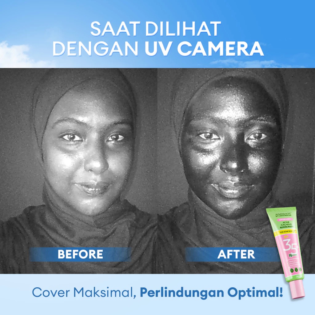 Animate Upgrade+ Acne Calming Sunscreen SPF 35 PA++++ 20gr