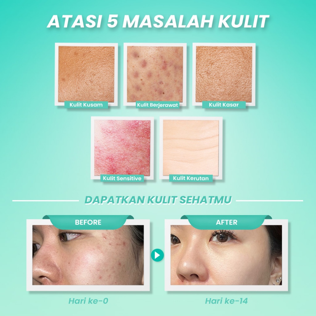 Hanasui Ceramide Probiotics Moisturizer Gel 30gr