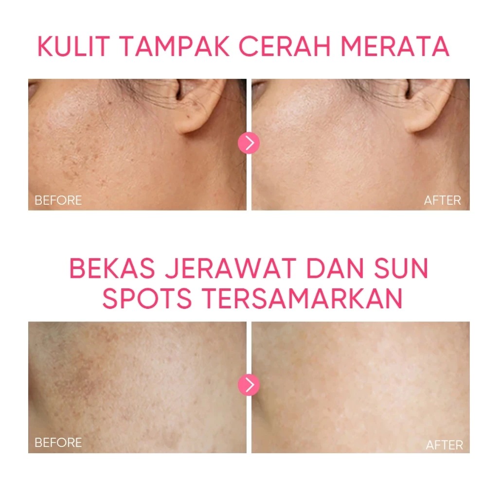 Skintific TXA Niacinamide Brightening Moisturizer 30gr